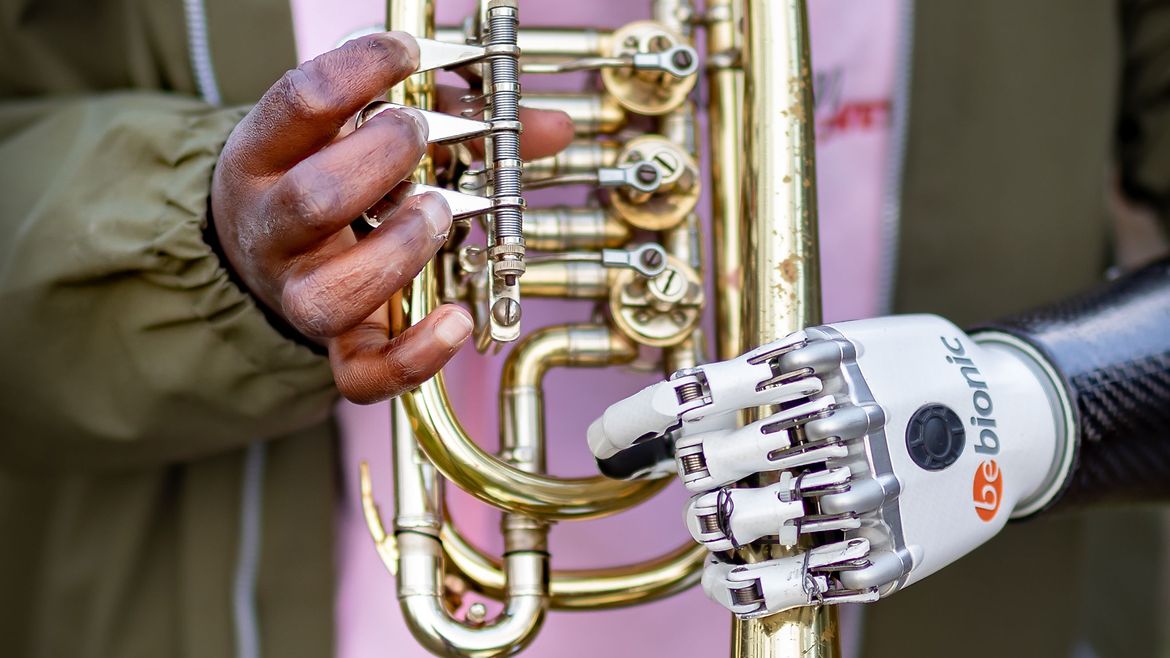 Eine Trompete wird von einer Hand und einer Handprothese gehalten.
