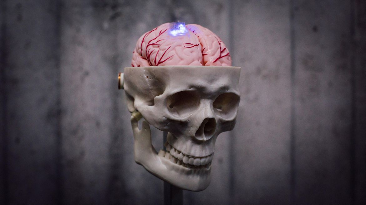 Modell eines menschlichen Schädels. Die obere Hälfte fehlt, sodass das Gehirn sichtbar ist.