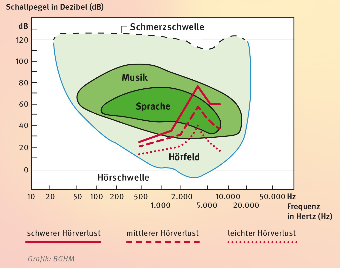 Schallpegeldiagramm mit x und y Achse. Die y-Achse bezeichnet db (Dezibel von 10 bis 120 db) und die x-Achse zeigt Hörschwelle in hz (Frequenz in Hertz ). Bezeichnet ist die Fläche des Hörfeldes, die Fläche zwischen Hörschwelle und Schmerzschwelle und Werte für leichten, mittleren und schweren Hörverlust. 