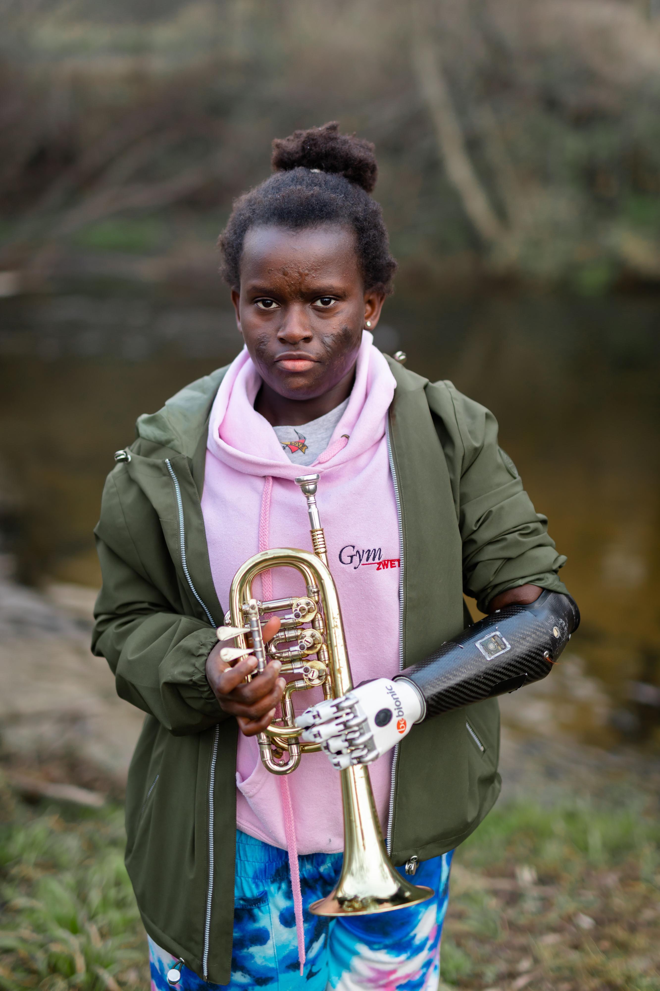 Eine junge Frau steht im Wald. Links trägt sie eine Handprothese. Sie hält eine Trompete.