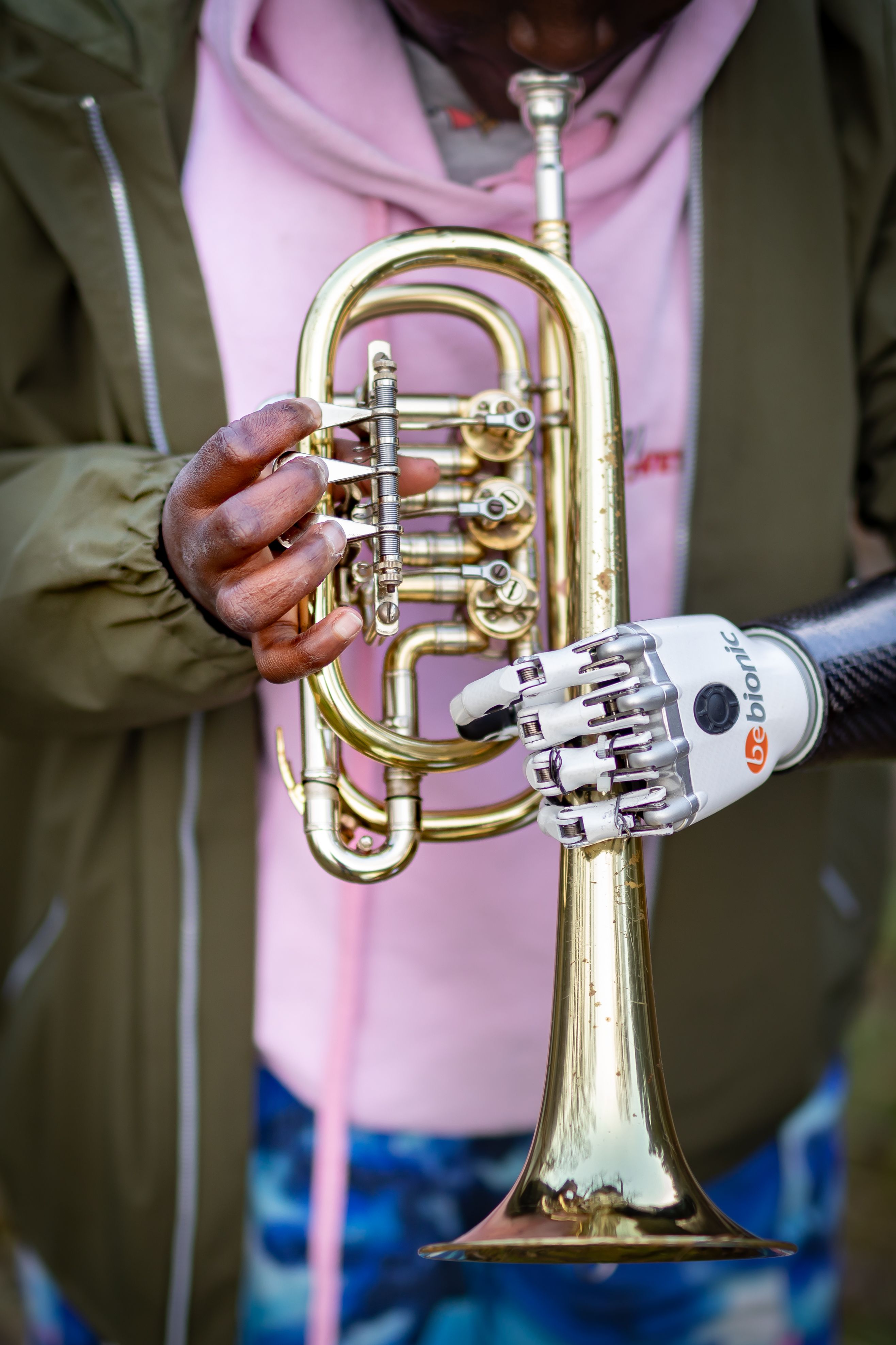 Eine Trompete wird von einer Hand und einer Handprothese gehalten.