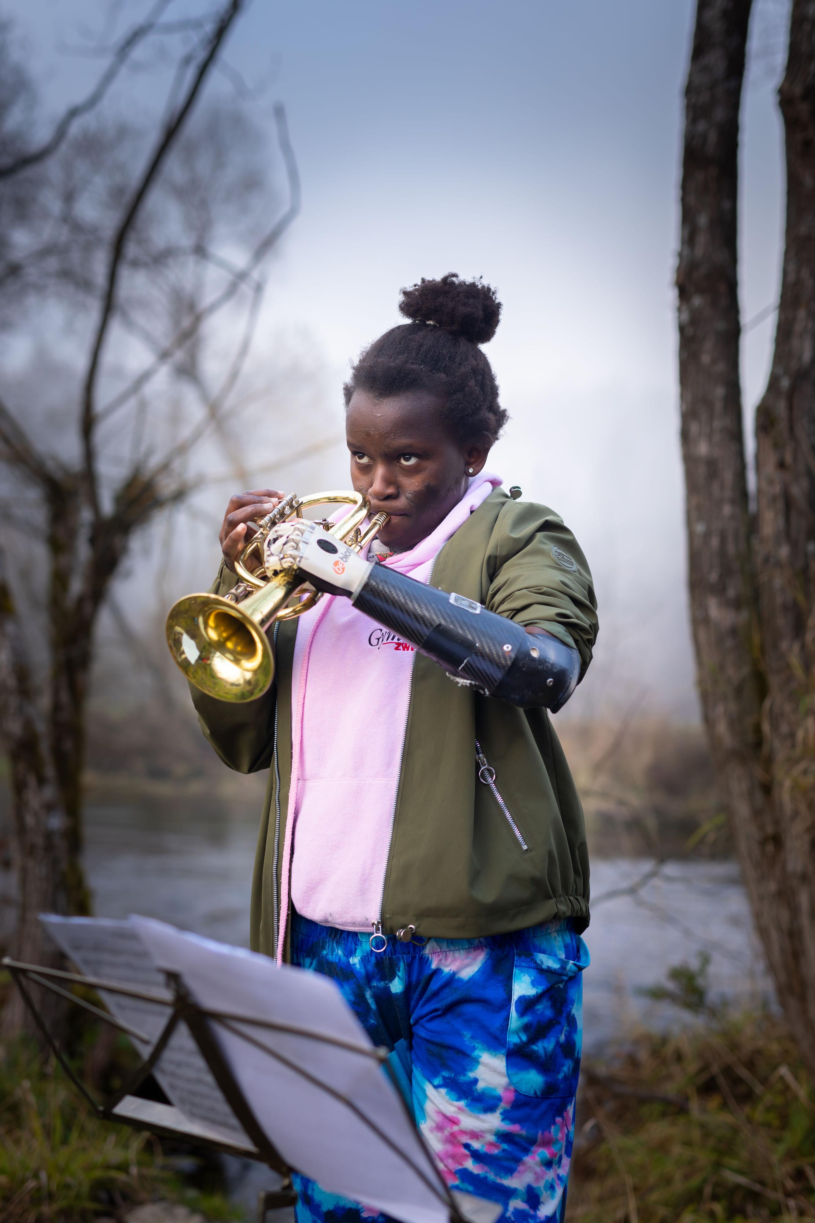 Eine junge Frau mit dunkler Hautfarbe steht im Wald und spielt Trompete. Links trägt sie eine Handprotese.