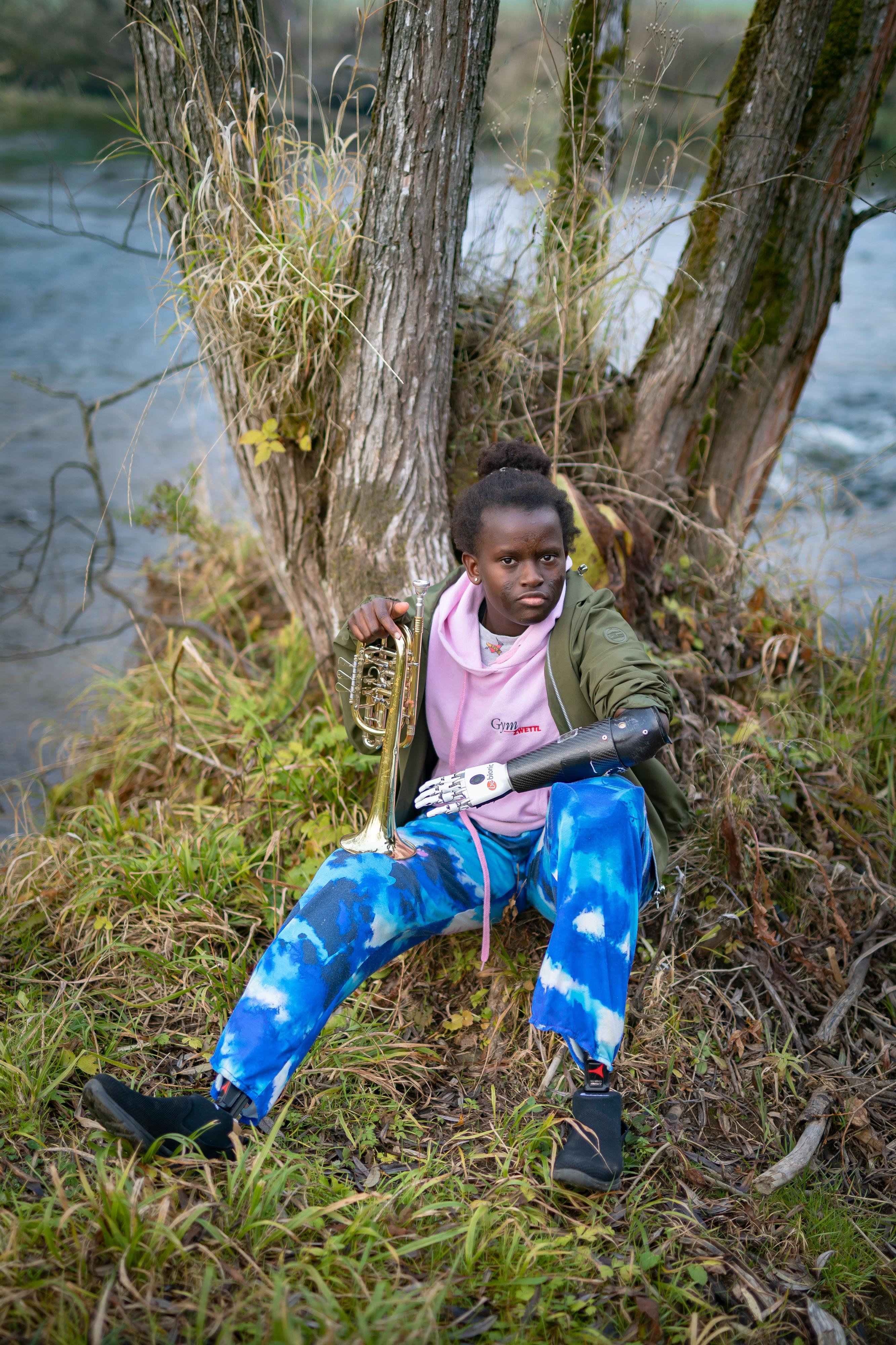 Eine junge dunkelhäutige Frau sitzt an einem Baum ein einem Flussufer. Links trägt sie eine Handprothese.