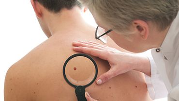 Untersuchung Muttermal Hautärztin untersucht Muttermal