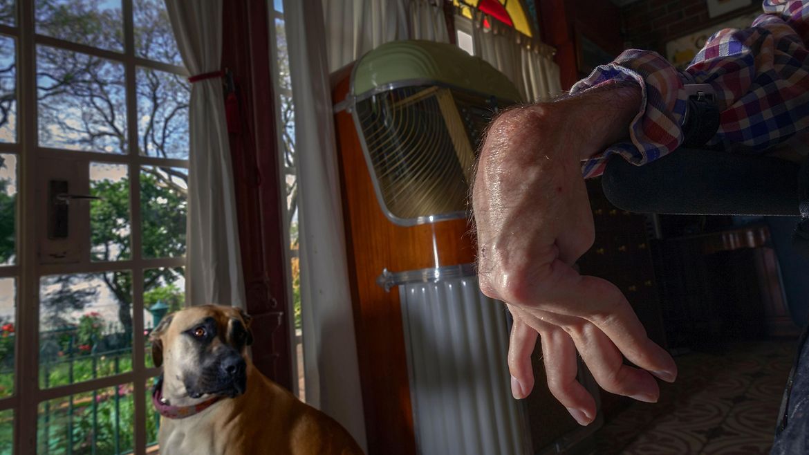 Ein großer brauner Hund sitzt an einem Fenster und schaut ins innere des Zimmers. Im Vordergrund die spastisch gelähmte Hand eines Menschen.