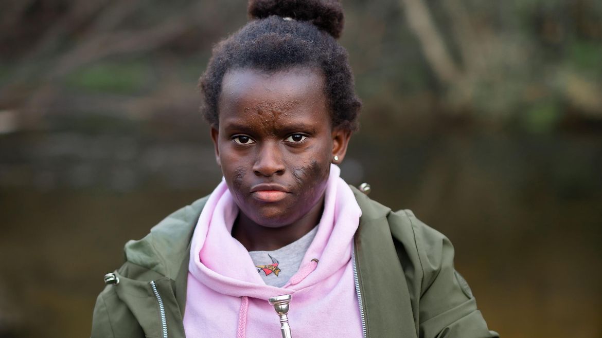 Eine junge Frau steht im Wald. Links trägt sie eine Handprothese. Sie hält eine Trompete.