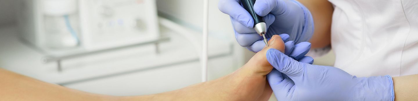 Podologie Person mit Handschuhen behandelt mit einer elektrischen Pfeile die Fußnägel einer anderen Person